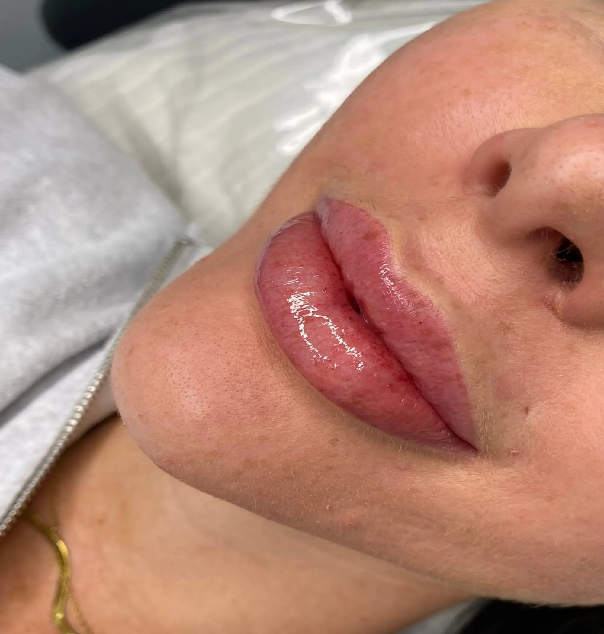 correcting uv-reactive lip tattoo mistakes