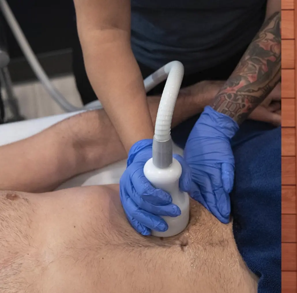 cryo therapy skin tightening protocol explained
