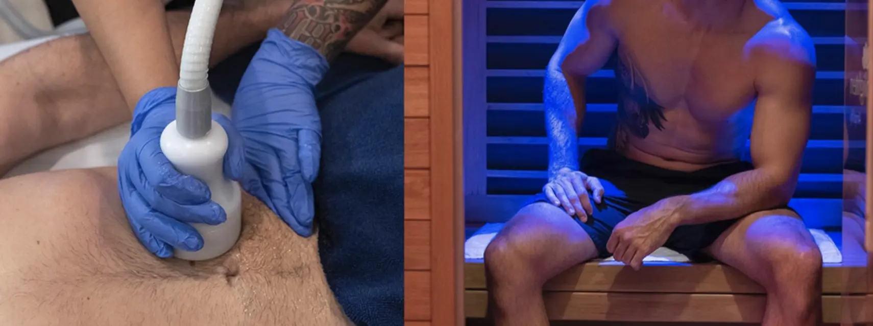 cryo toning for loose skin after weight loss