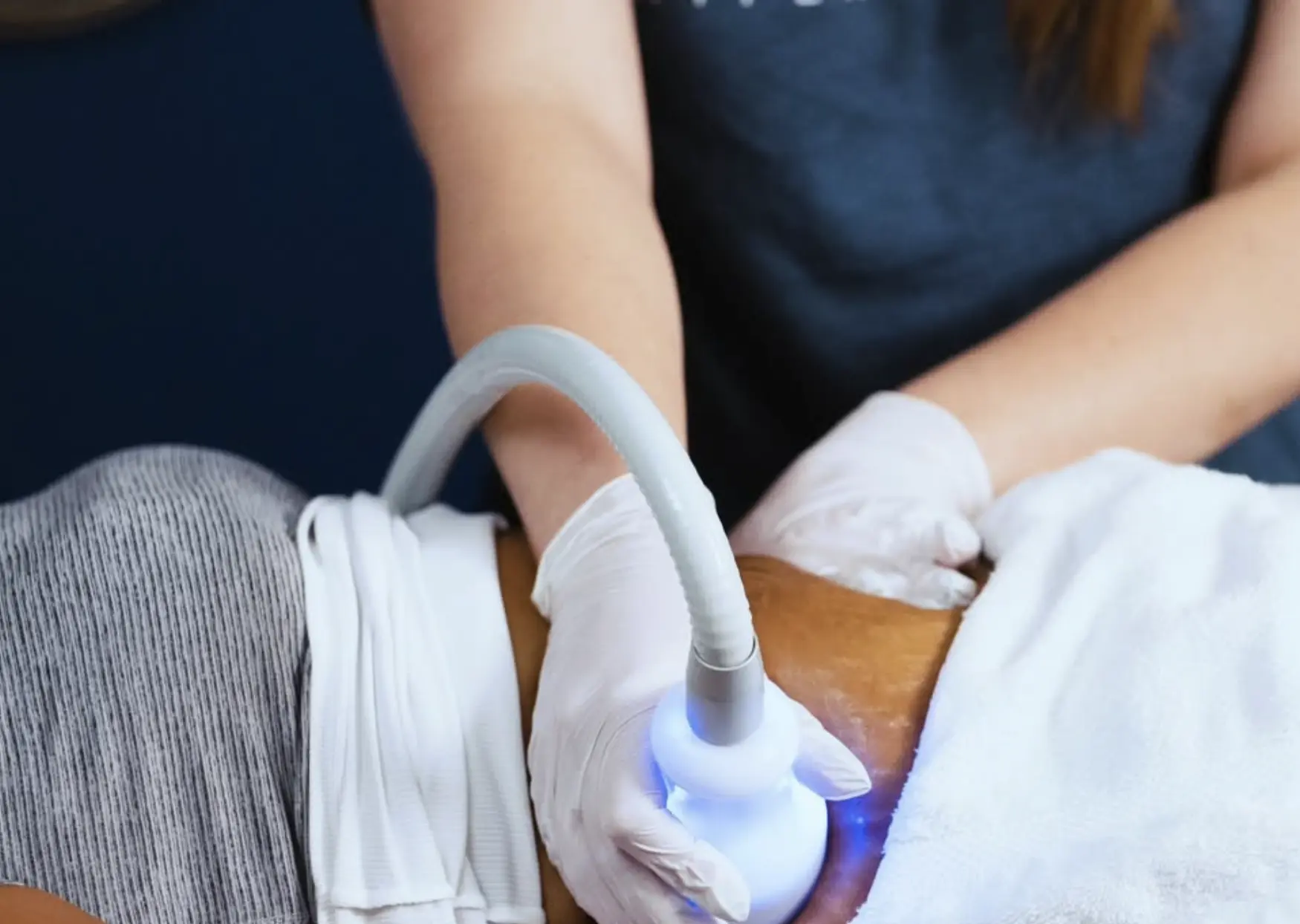 cryo toning sessions frequency for tightening