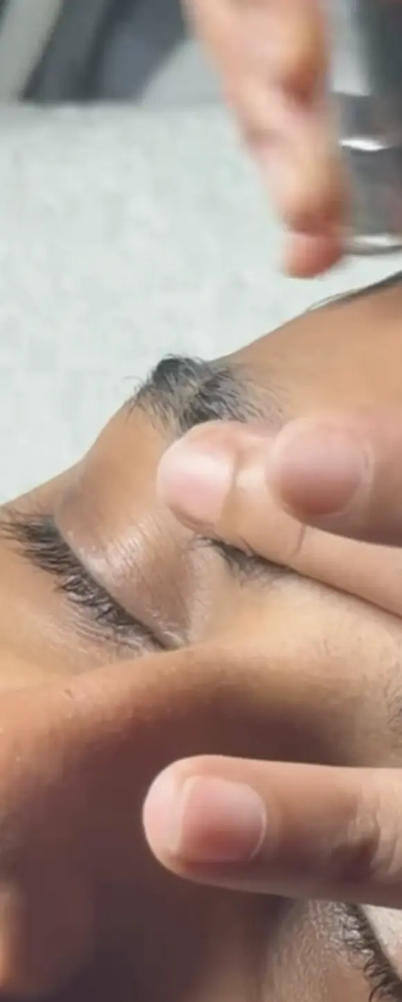 Valerie's Adventure Time | Microdermabrasion For Men: Does It Help With Beard Ingrowns And ‘Maskne’ Scarring? does microdermabrasion clear clogged pores beard area