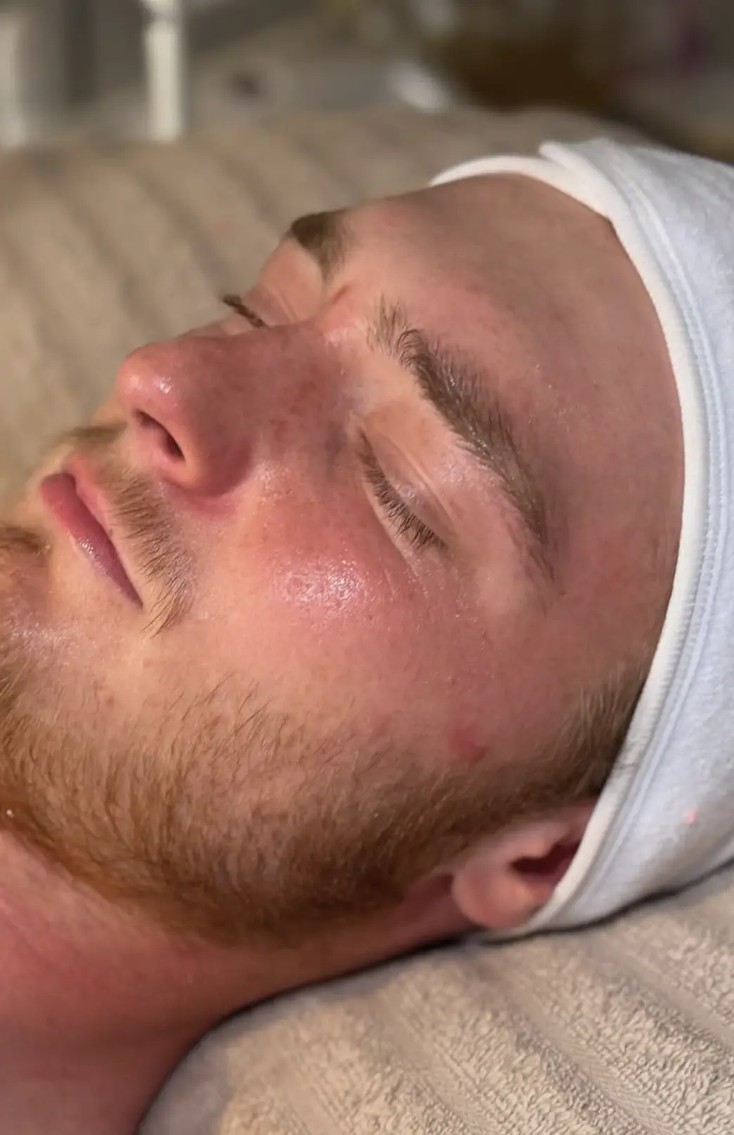Valerie's Adventure Time | Microdermabrasion For Men: Does It Help With Beard Ingrowns And ‘Maskne’ Scarring? does microdermabrasion help ingrown hairs beard