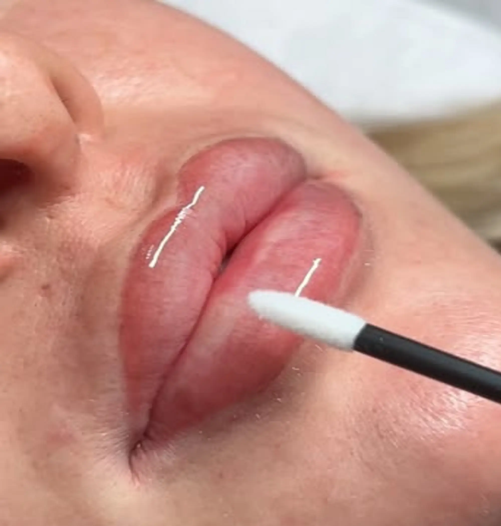 lips under uv light reaction