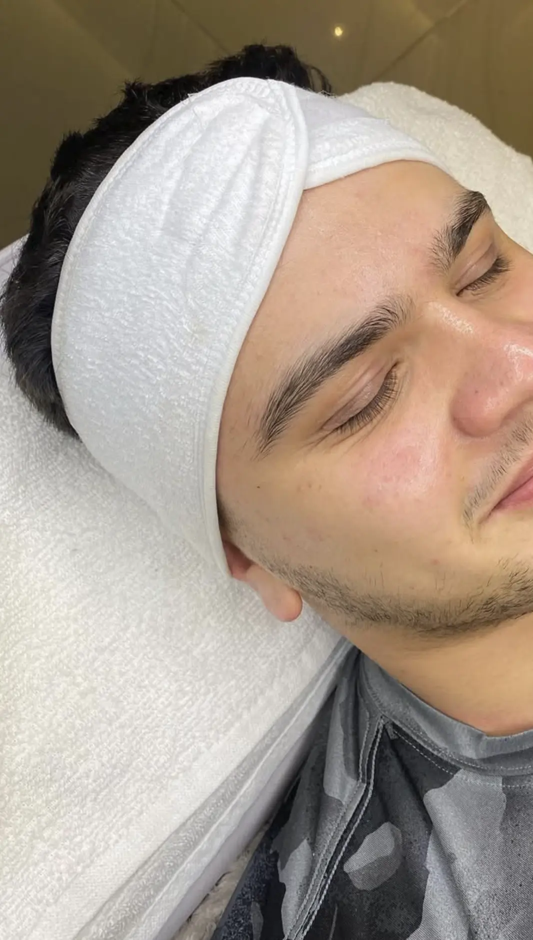Valerie's Adventure Time | Microdermabrasion For Men: Does It Help With Beard Ingrowns And ‘Maskne’ Scarring? microdermabrasion benefits for men facial skin