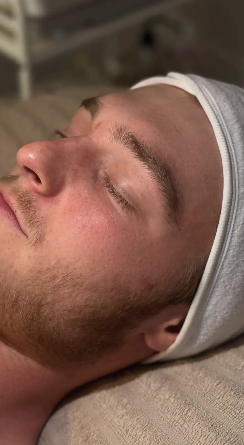 Valerie's Adventure Time | Microdermabrasion For Men: Does It Help With Beard Ingrowns And ‘Maskne’ Scarring? microdermabrasion for maskne scarring men